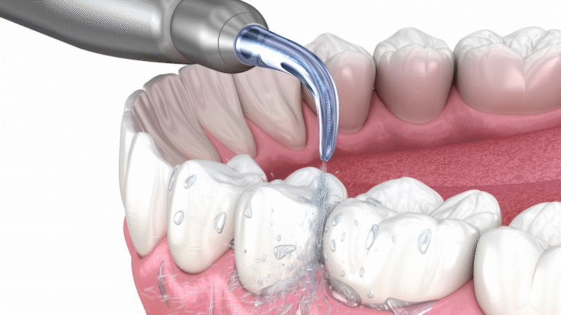 Oral irrigator